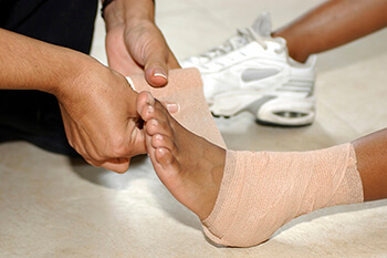 ankle sprain