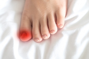 Understanding Ingrown Toenails