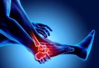 Symptoms of Foot and Ankle Osteoarthritis