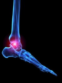 How Rheumatoid Arthritis Can Affect the Feet 