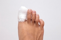 Broken Toes and Treatment Methods