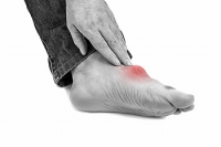 How Gout Can Develop