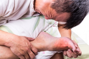 Causes of Gout